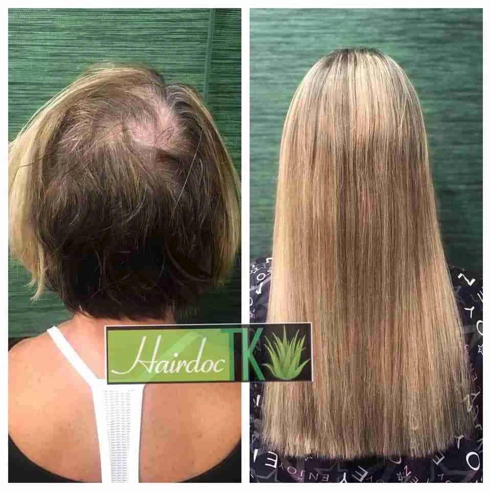 trichotillomania-hair-loss-extensions-thinning-hair-scottsdale-salon