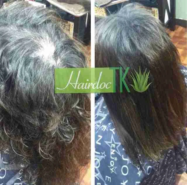 trichotillomania-hair-loss-hair-extensions-scottsdale-hair-expert