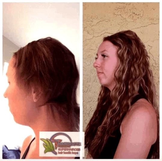 curly-hair-extensions-hairdoctk-cancer-survivor-extensions