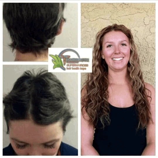 curly-hair-extensions-hairdoctk-cancer-survivor-extensions